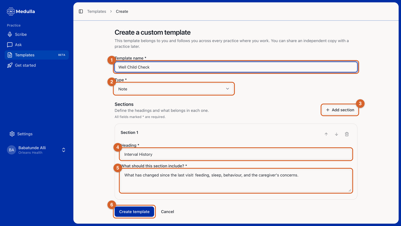 Creating a custom template
